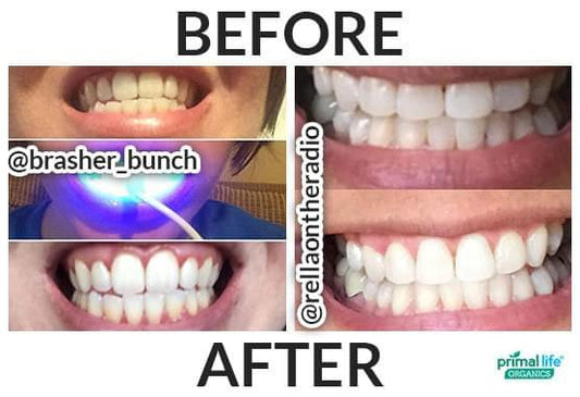 Natural Teeth Whitener